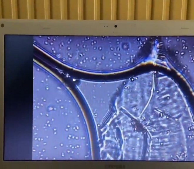 This is Mind Blowing. This was shown at a Wellness Convention. This is the Pfizer mRNA under 2000x magnification. They are unsure of the exact nature, but it looks like a living organism which contains moving particles. They’re now sending these images to Immunologist Dr. Capel