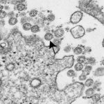 Dr. Tom Cowan: The Smoking Gun? — Study Shows ‘Virus’ Is Identical to Normal Cell ‘Structures’