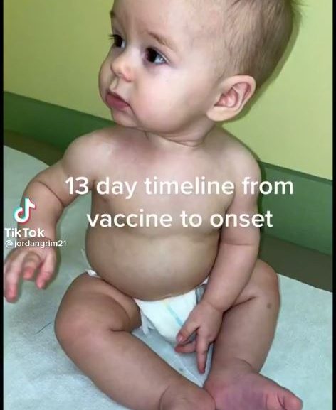 13 Day timeline from vaccine to onset.